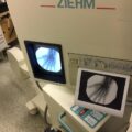 Mobile C-ARM Ziehm 8000